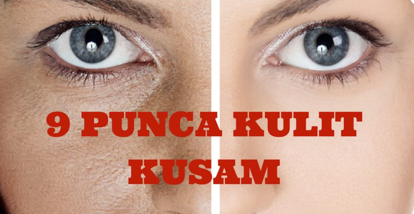 RUTIN PENJAGAAN UNTUK KULIT KUSAM & KERING